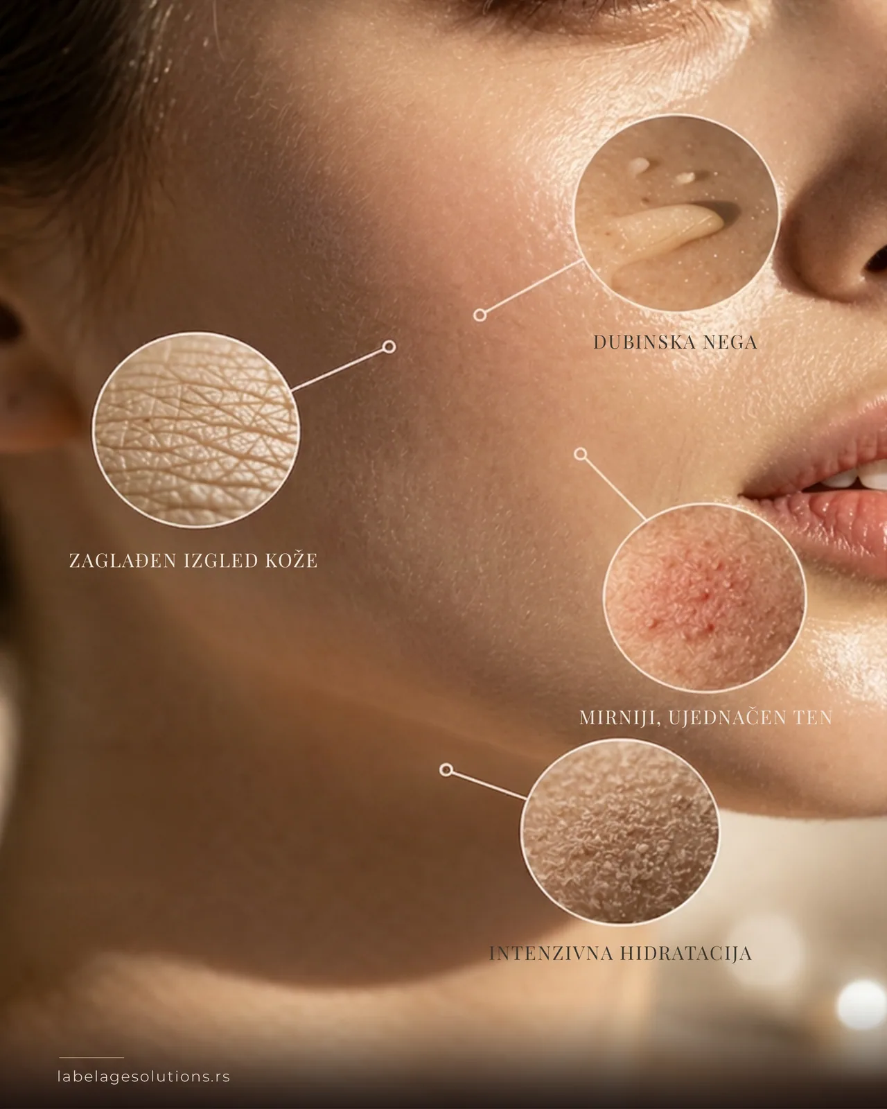 L’Abelage - 3